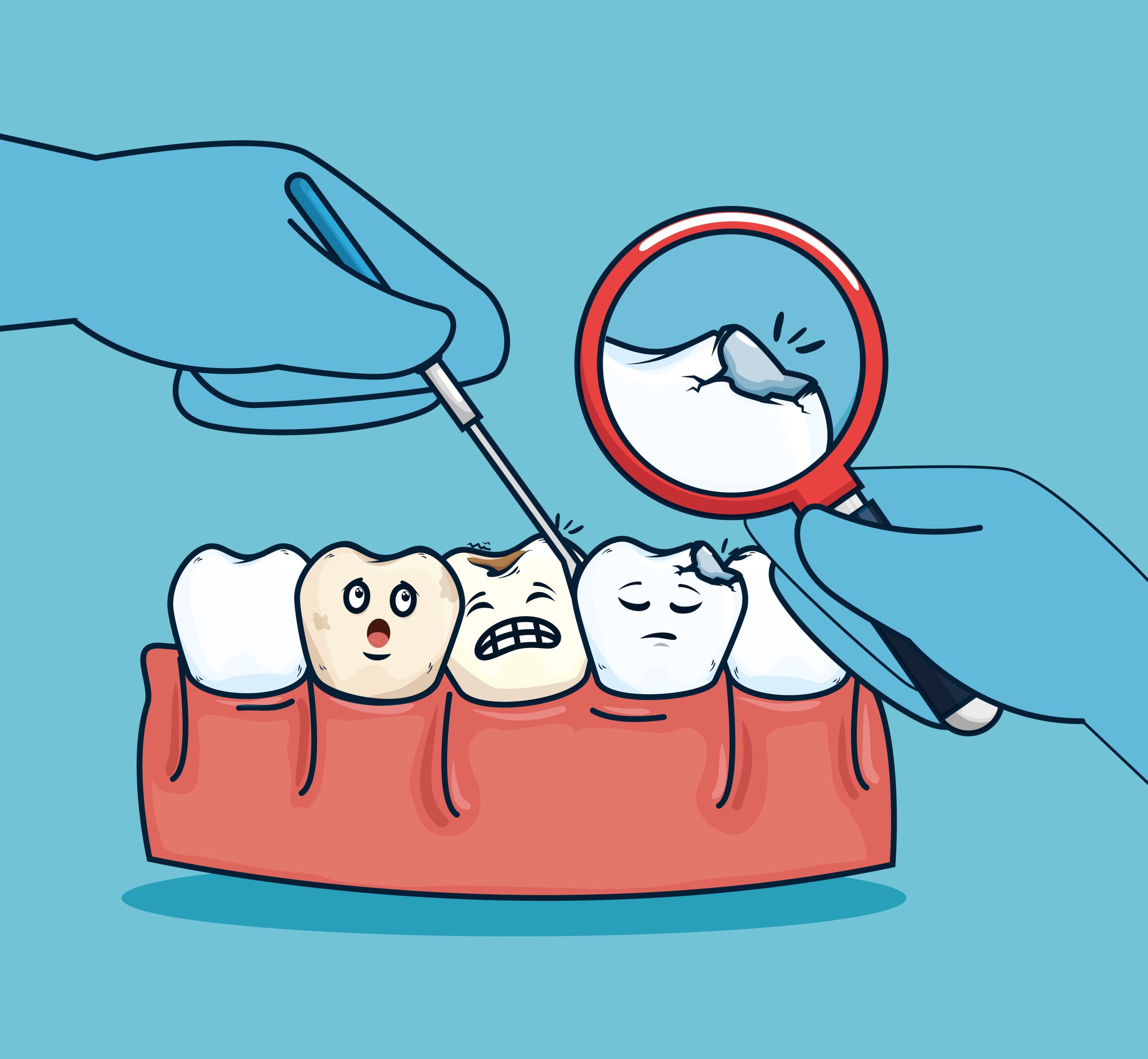 ¿Por qué sigo teniendo caries si me cepillo todos los días?